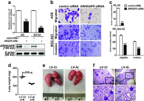 Arhgap5 Downregulation Suppresses Migration Invasion And Metastasis Download Scientific