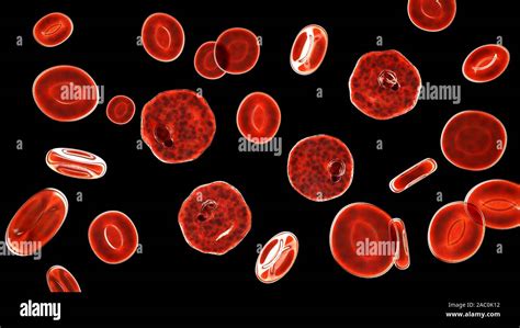 Plasmodium Vivax Dentro De Los Glóbulos Rojos Ilustración Fotografía De Stock Alamy