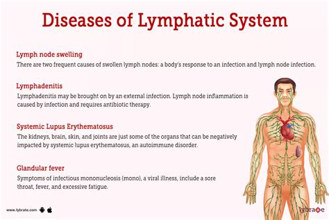 Lymphatic System Human Anatomy Picture Functions Diseases And