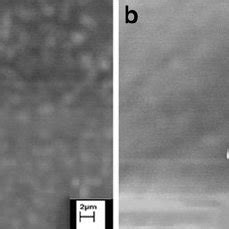 Scanning Electron Micro Graph Of The Oral Opening Of The Male O