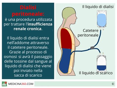 Dialisi Peritoneale Manuale O Automatizzata Procedura Complicanze E