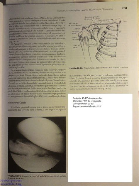 Anteversao E Retroversao Do Ombro Traumatologia E Ortopedia