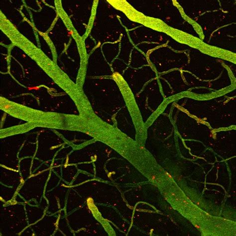 1 mm de cerebro de ratón En verde observamos los capilares que