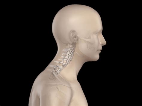 Do You Have Forward Head Posture Spineology Chiropractic