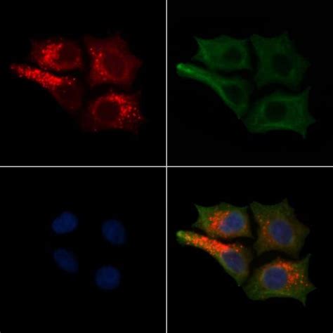 NF H Polyclonal Antibody Invitrogen 100 μL Unconjugated Fisher