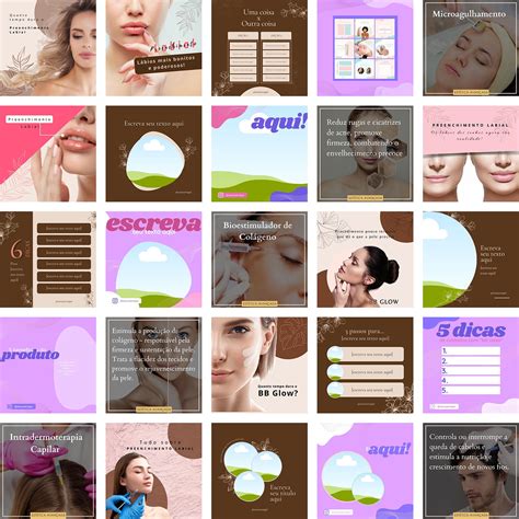 Pack Canva Estética Templates Editáveis 290 Artes Bônus