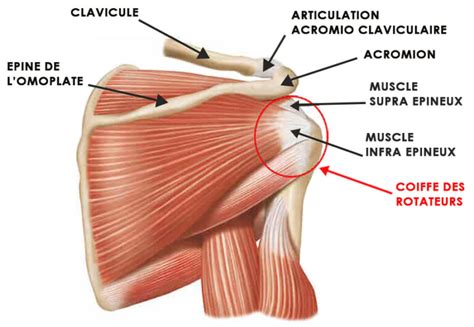 R Paration De La Coiffe Des Rotateurs Chirurgie De L Paule Nice