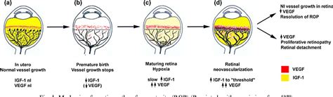 Pathogenesis Of Retinopathy Of Prematurity Semantic Scholar