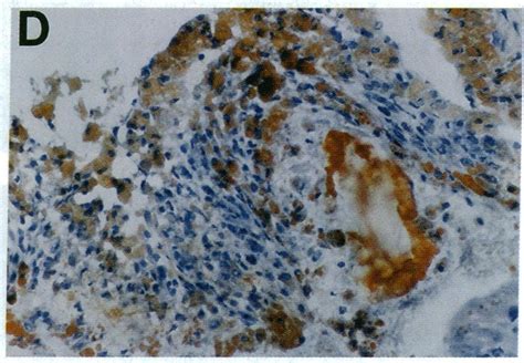 Atherosclerotic Lesions In The Coronary Sinus Of Ldlr Mice B D As