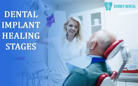 Dental Implant Healing Stages Helpful Information