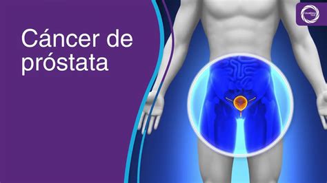 Cancer De Prostata Imagenes