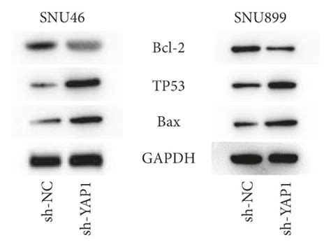 Yap Knockdown Inhibits Malignant Phenotypes Of Lscc Cells A Rt Qpcr