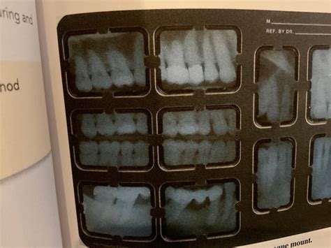 DH 11 Radiology Chapter 20 Flashcards Quizlet