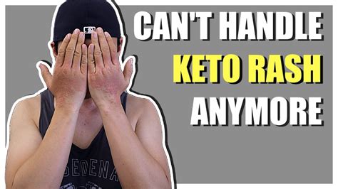 I Cant Handle My Keto Rash Anymore Youtube