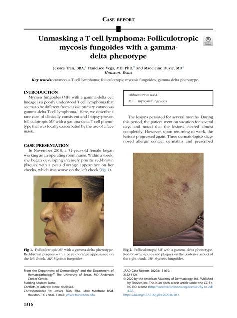 PDF Unmasking A T Cell Lymphoma Folliculotropic Mycosis Fungoides