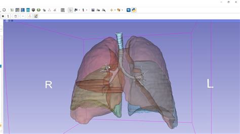 Lung And Lobe Segmentation With Lungmask AI In 3D Slicer YouTube