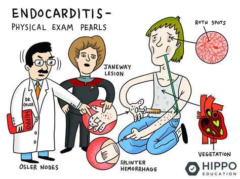 Endocarditiss Clip Art Library