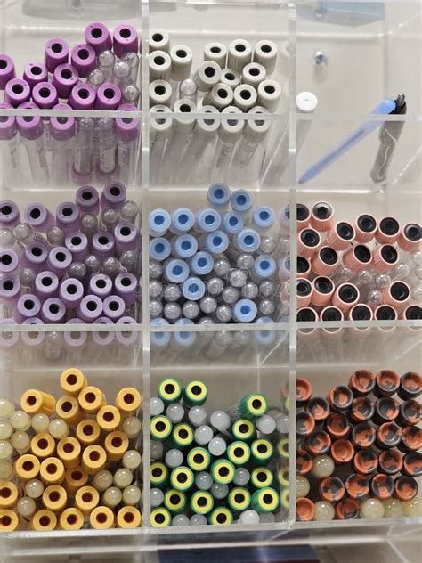 Healthcare and Medicine! Laboratory Blood Vials! Stock Photo - Image of ...