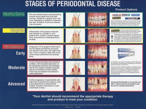 Stages Of Gumperiodontal Disease In 2020 Periodontitis Periodontal Disease Periodontal