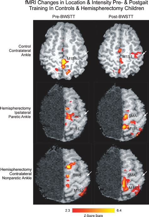 Representative Functional Magnetic Resonance Imaging Fmri Activation Download Scientific