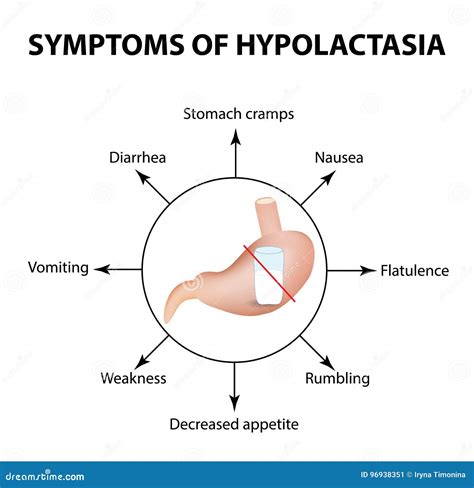 Lactose Intolerance Symptoms And Treatment. Infographic Poster With