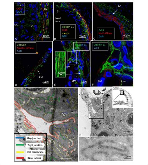 Confocal Super Resolution Sr Sim And Transmission Electron Download Scientific Diagram