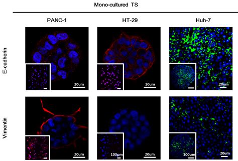 Microfluidic Co Culture Of Pancreatic Tumor Spheroids With Stellate