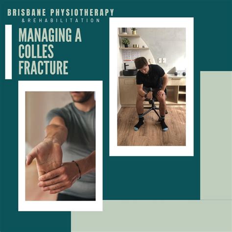 What is a Colles Fracture? - Brisbane Physiotherapy