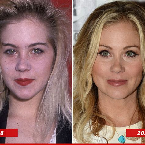 Christina Applegate Surgery