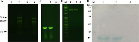 A Rnase Activity Assay Of Quinoin I On Total Rna Extracted From The