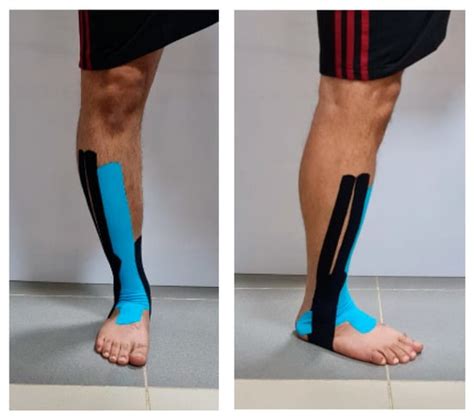 Healthcare Free Full Text The Effect Of Kinesio Taping On Balance