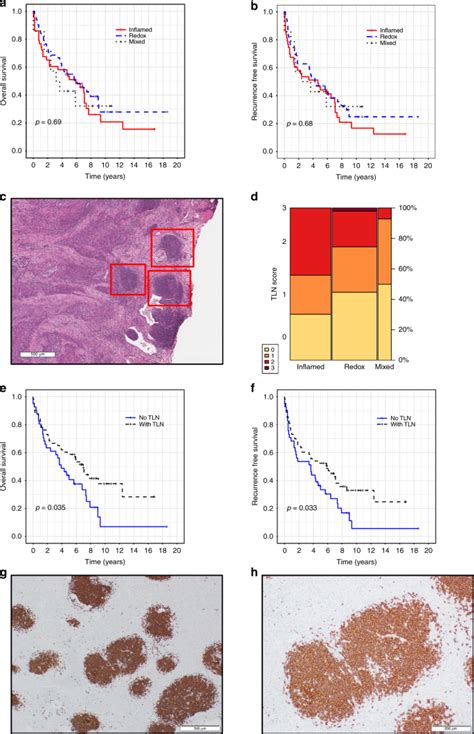 Proteogenomic Landscape Of Squamous Cell Lung Cancer Nature