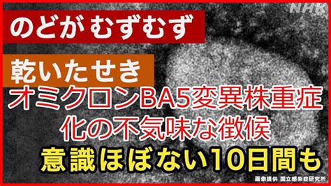 【最新ニュース】オミクロンba5変異株重症化の不気味な徴候。一月万冊 株式投資 動画まとめ