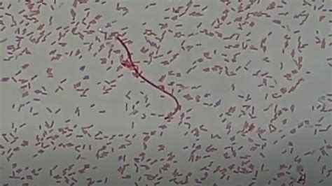 Proteus vulgaris: Introduction, Identification Features, Keynotes