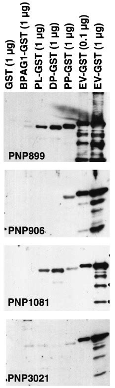 Pnp Sera Recognize Plakin Tail Gst Fusion Proteins Western Blot Of