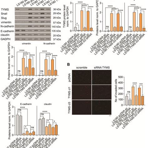 Tyms Silencing Reversed The Emt Process And Inhibited The Invasion
