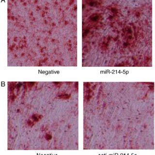 Adipogenic Differentiation Was Measured By Oil Red O Staining Following