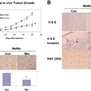 Increased Merlin Levels Inhibit In Vivo Melanoma Growth And Invasion