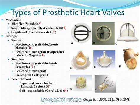 Prosthetic valve function