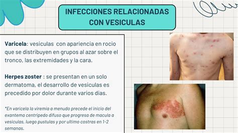 Infecciones De Piel Y Partes Blandas 2024 Pptx