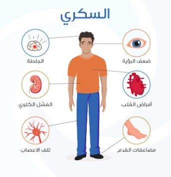 الأسبوع | ما هو مرض السكري الأكثر شيوعا؟.. الأسباب والأعراض وطرق العلاج