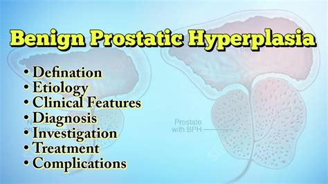 Benign Prostatic Hyperplasia Surgery Lecture Treatment At Home