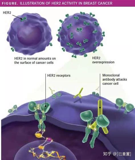 Her2阳性乳腺癌最新研究进展盘点（靶向，免疫，疫苗） 知乎