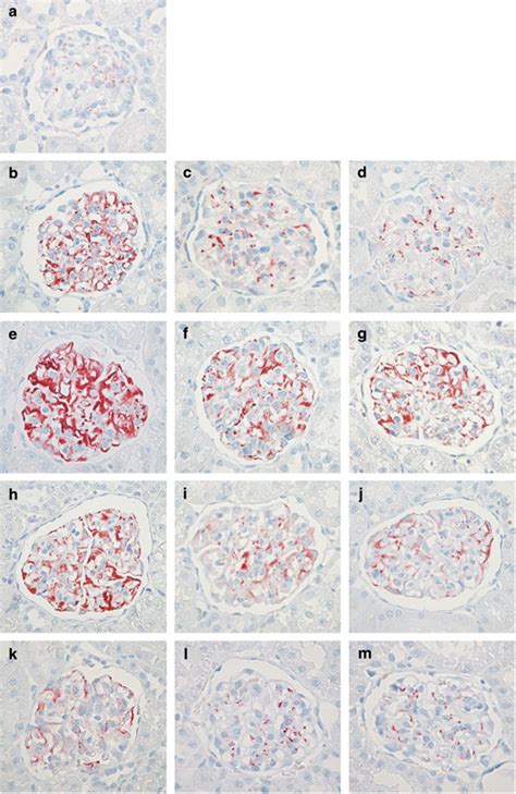 Triptolide Restored The Expression Of Podocytes Nephrin And Podocin In