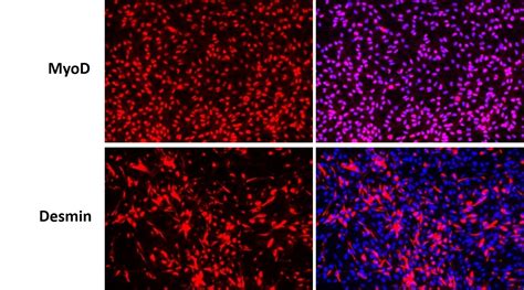 Human Skeletal Muscle Myoblasts IPSC Derived Normal Cell Model