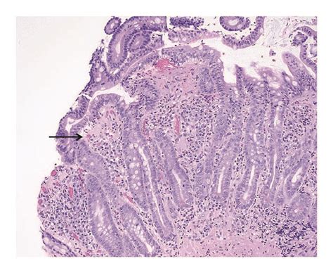 20x Magnification A Hematoxylin And Eosin Stained Section Of The