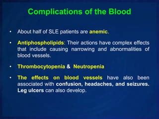 Complications of systemic lupus erythematosus | PPT