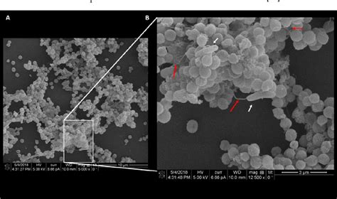 Figure 1 From Biofilm Of Helicobacter Pylori Life Cycle Features And