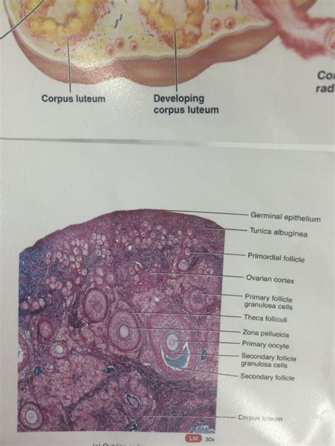 Ovary histology | Corpus luteum, Ovaries, Ovarian