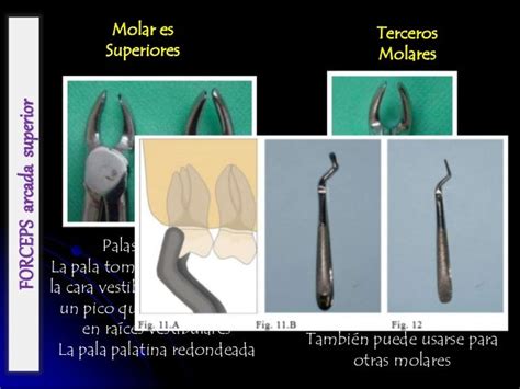 Instrumental Exodoncia